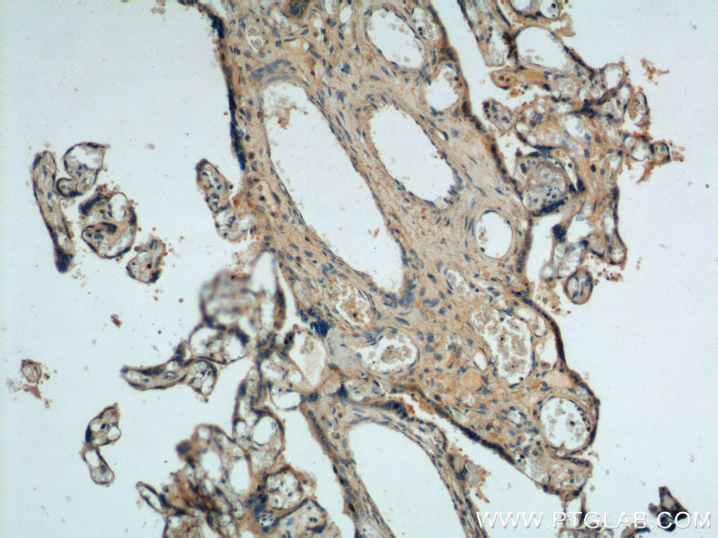 IHC staining of human placenta using 20252-1-AP