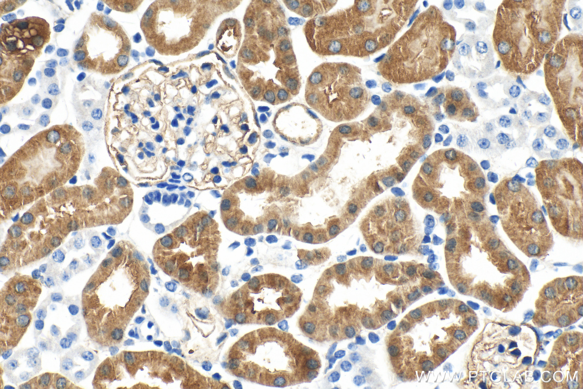 IHC staining of mouse kidney using 68446-1-Ig (same clone as 68446-1-PBS)