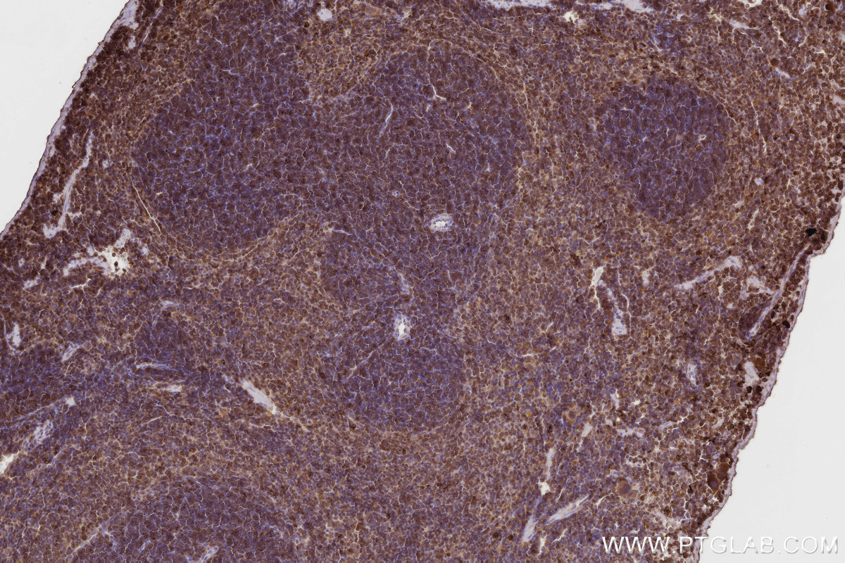 IHC staining of mouse spleen using 27056-1-AP IHC staining of mouse spleen using 27056-1-AP