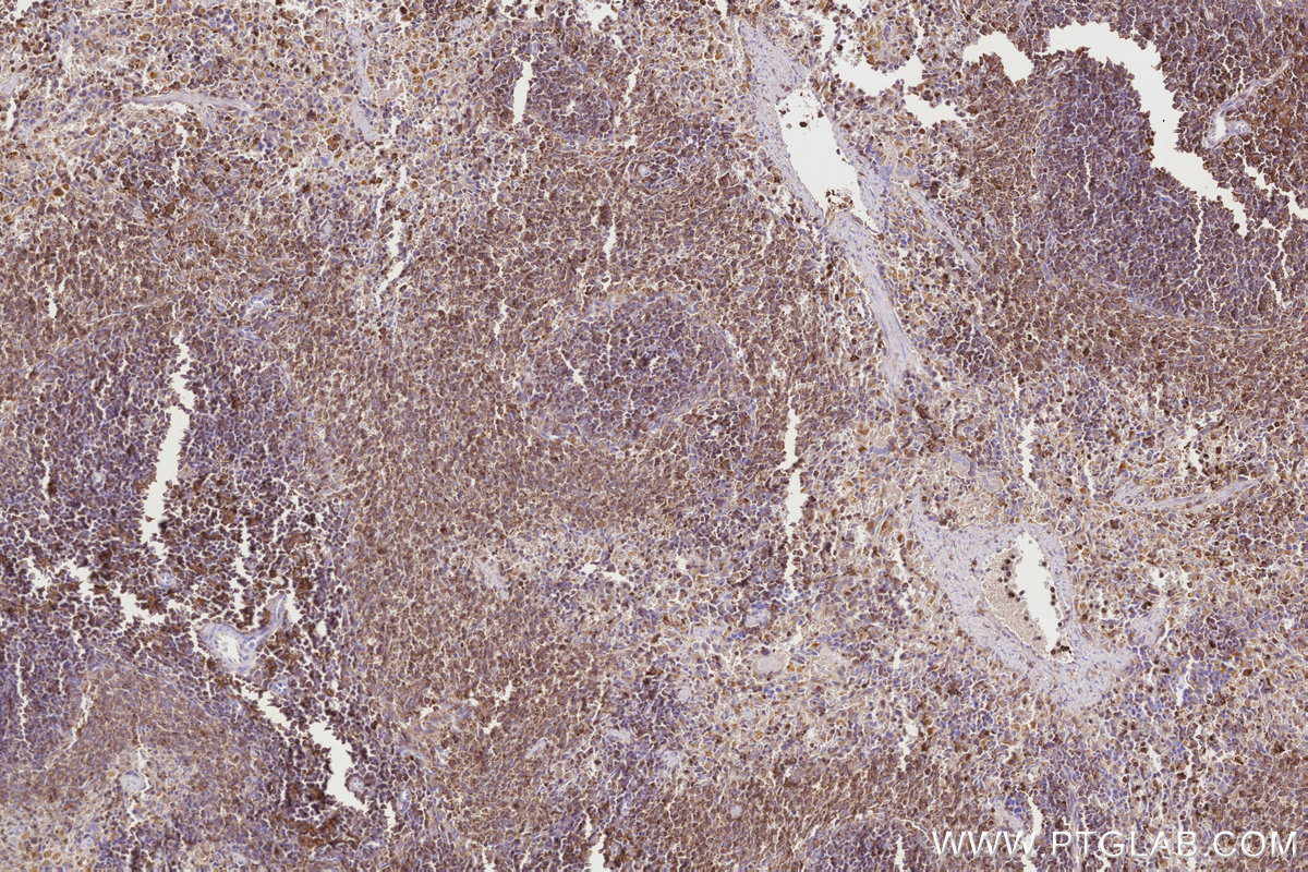 IHC staining of rat spleen using 27056-1-AP IHC staining of rat spleen using 27056-1-AP