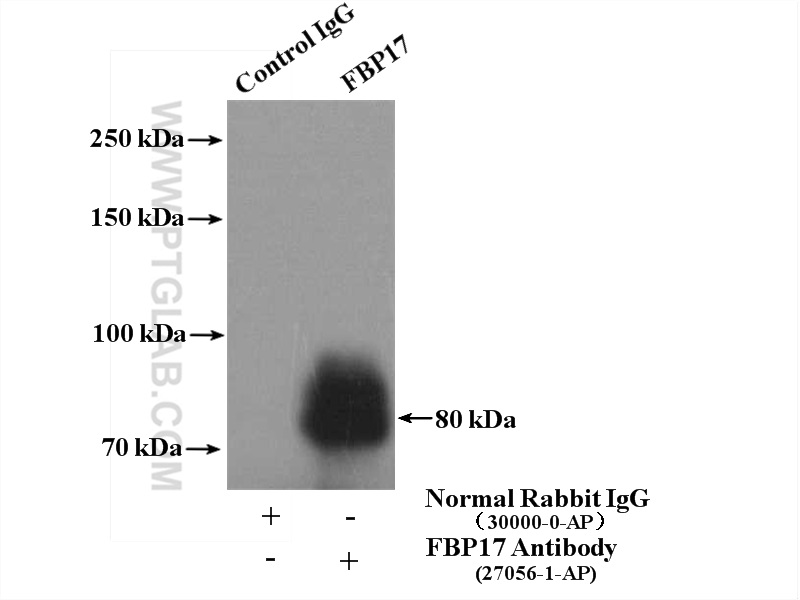 IP experiment of mouse brain using 27056-1-AP