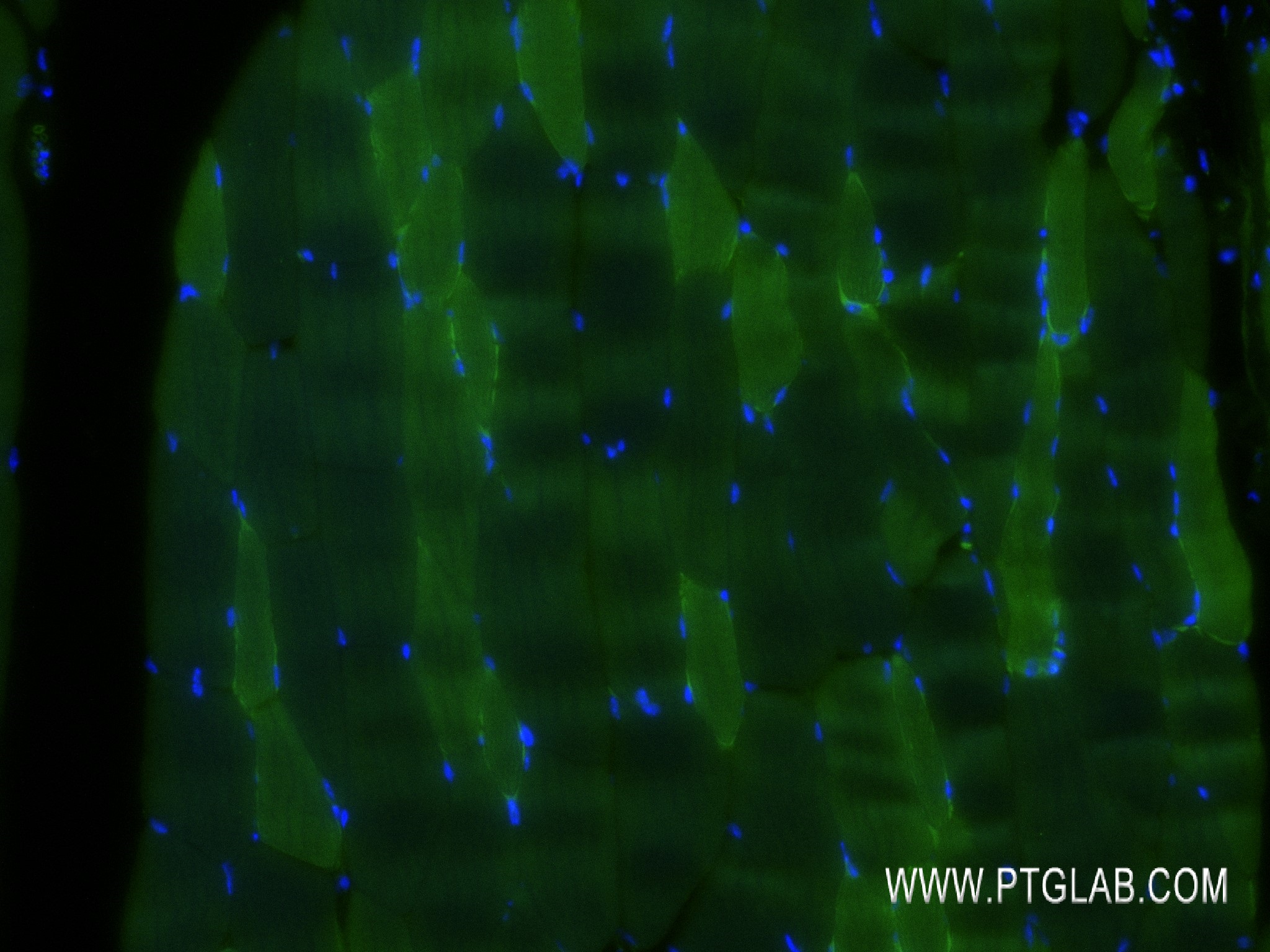 IF Staining of mouse skeletal muscle using 83910-5-RR