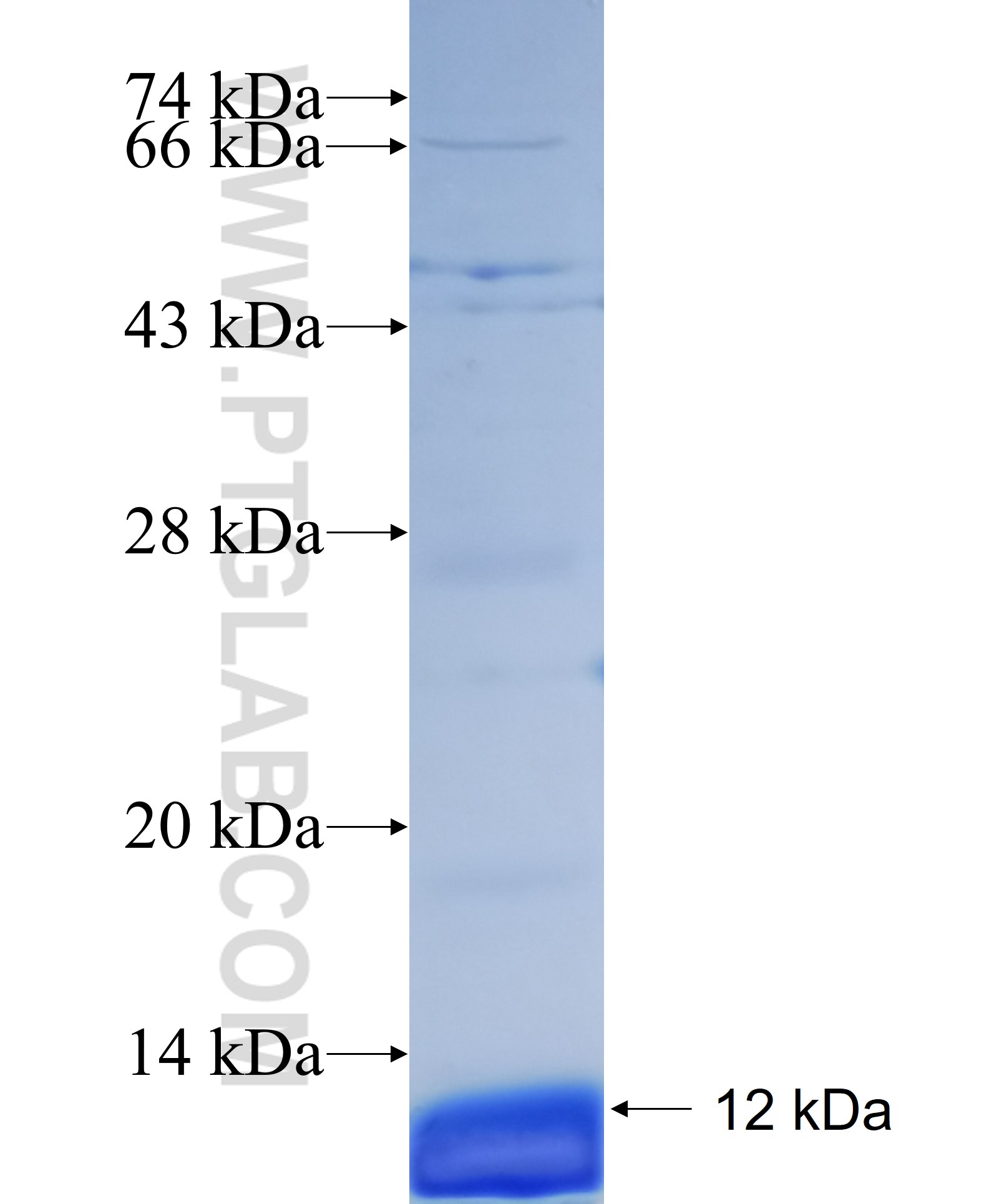 FBP2 fusion protein Ag18862 SDS-PAGE