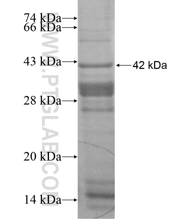 FBRS fusion protein Ag17514 SDS-PAGE FBRS fusion protein Ag17514 SDS-PAGE