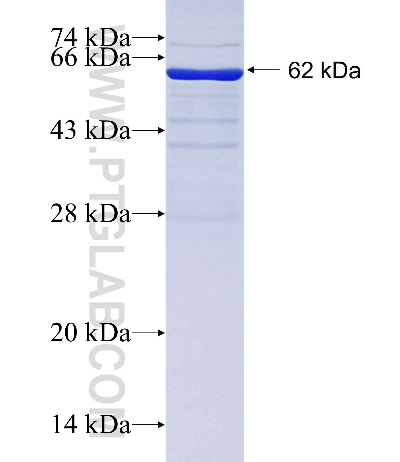 FBX4 fusion protein Ag4829 SDS-PAGE