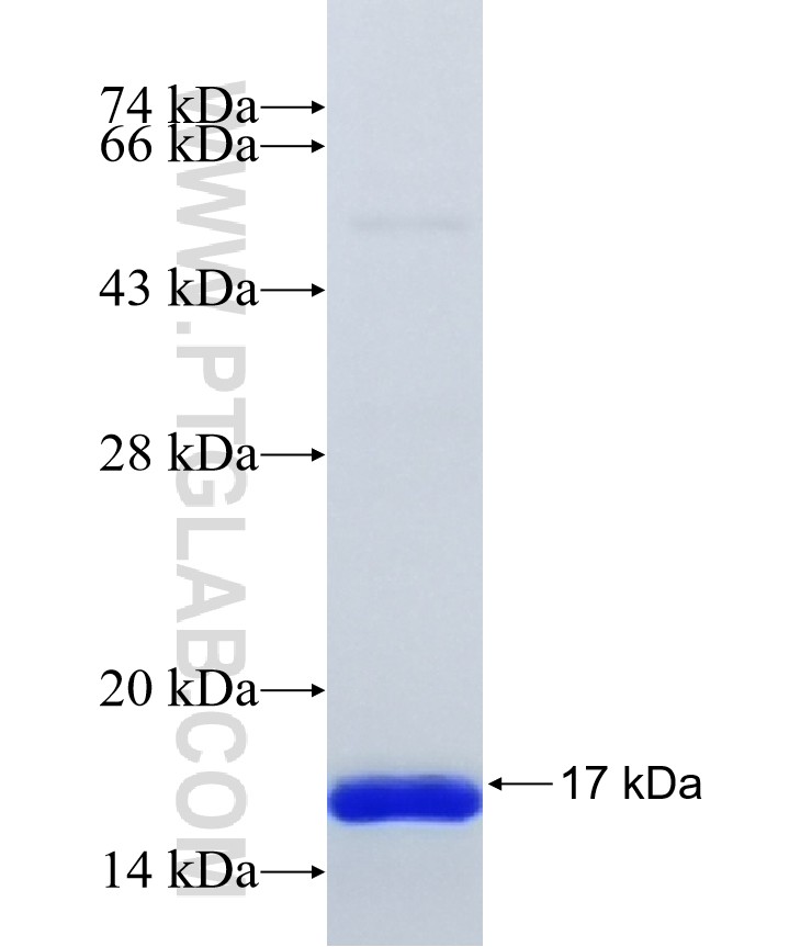 FBX43 fusion protein Ag40008 SDS-PAGE