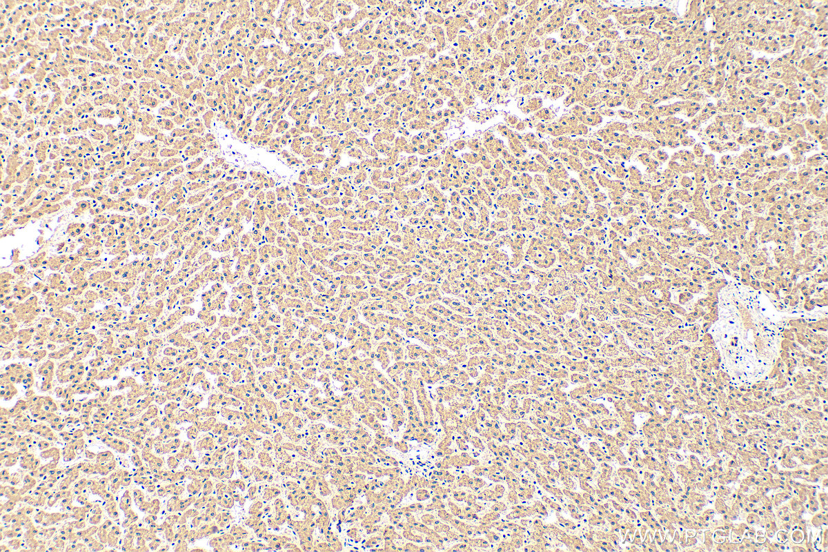 Immunohistochemical analysis of paraffin-embedded human liver tissue slide using 17139-1-AP (FBXL13 antibody) at dilution of 1:200 (under 10x lens). Heat mediated antigen retrieval with Tris-EDTA buffer (pH 9.0). IHC staining of human liver using 17139-1-AP