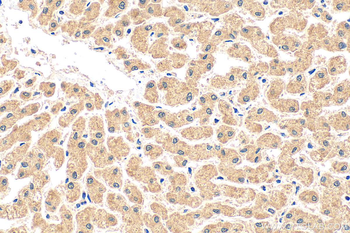 Immunohistochemical analysis of paraffin-embedded human liver tissue slide using 17139-1-AP (FBXL13 antibody) at dilution of 1:200 (under 40x lens). Heat mediated antigen retrieval with Tris-EDTA buffer (pH 9.0). IHC staining of human liver using 17139-1-AP