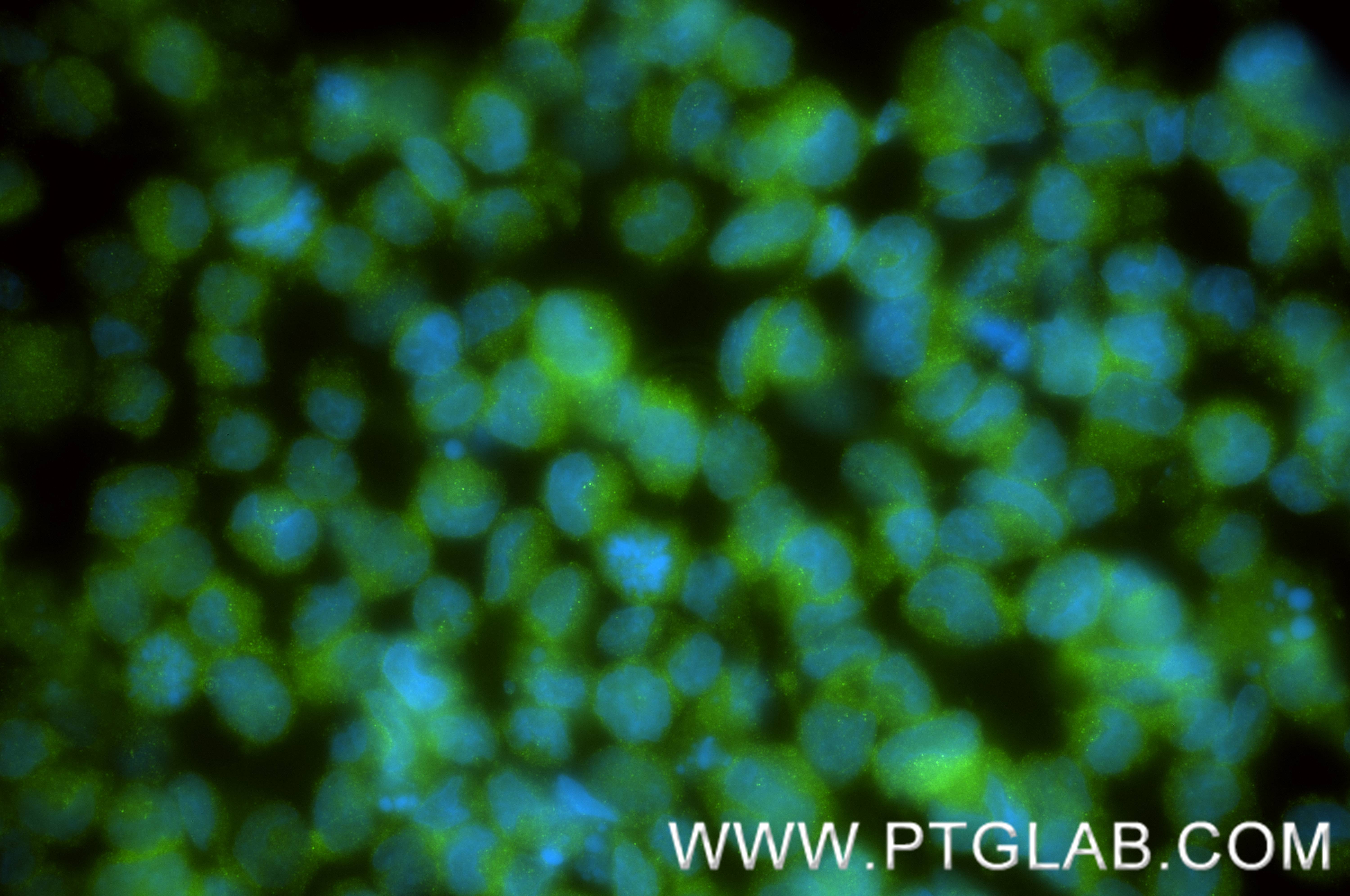 IF Staining of K-562 using 86857-1-RR (same clone as 86857-1-PBS) IF Staining of K-562 using 86857-1-RR (same clone as 86857-1-PBS)