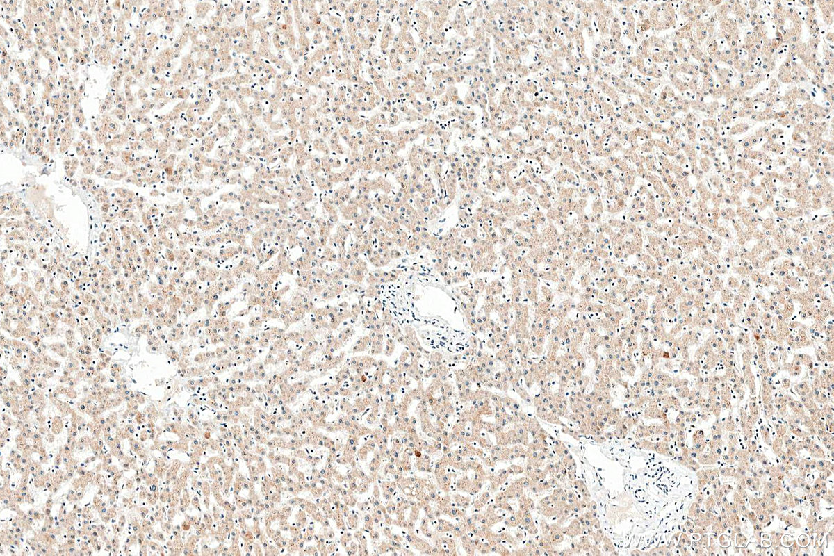 IHC staining of human liver using 13934-1-AP