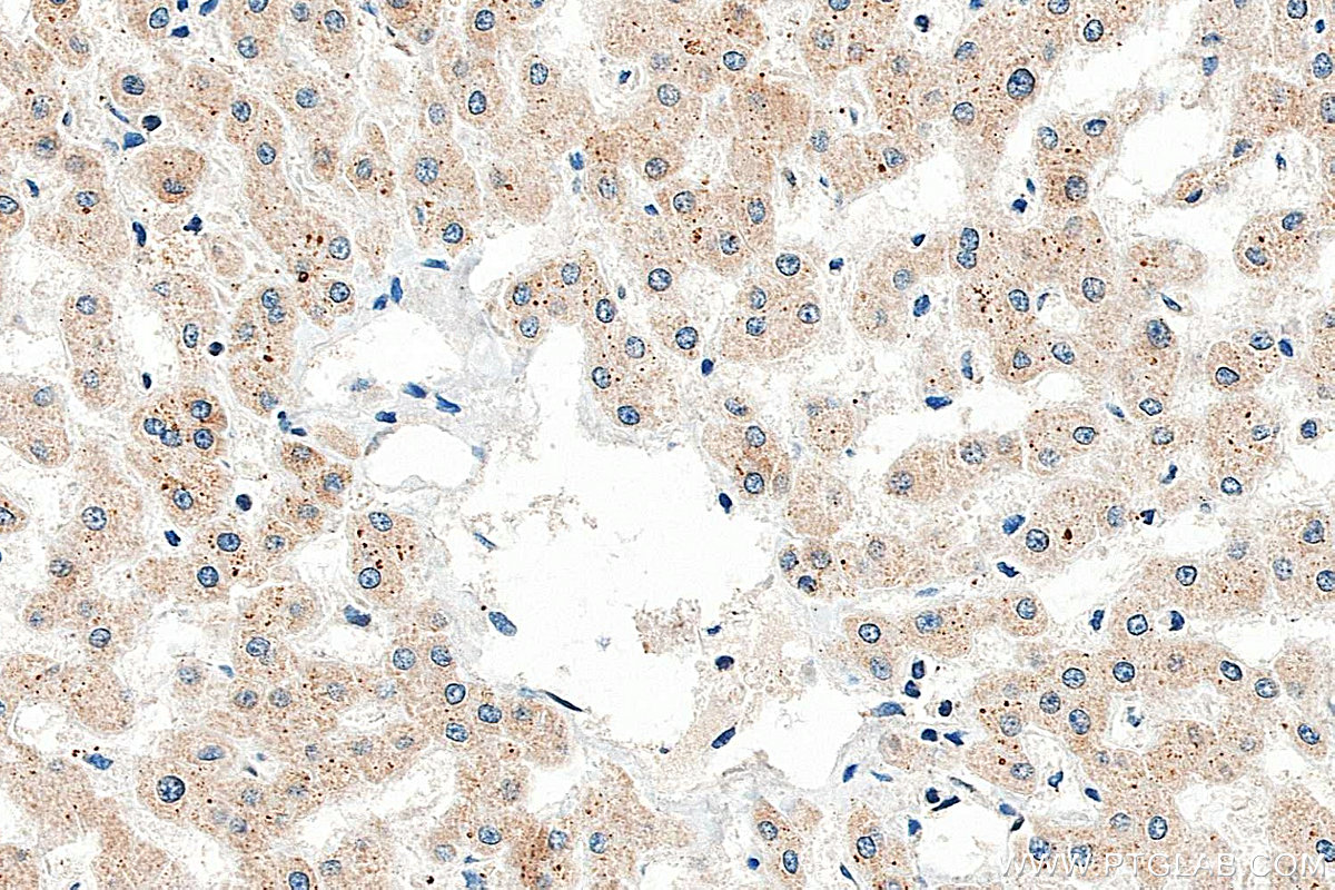 IHC staining of human liver using 13934-1-AP