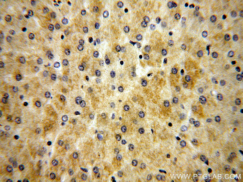 IHC staining of human liver using 13934-1-AP