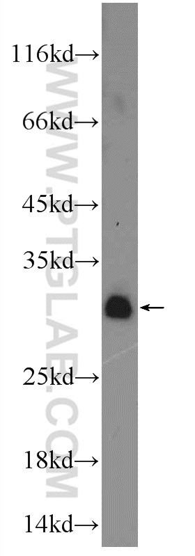 WB analysis of MDA-MB-453s using 20895-1-AP