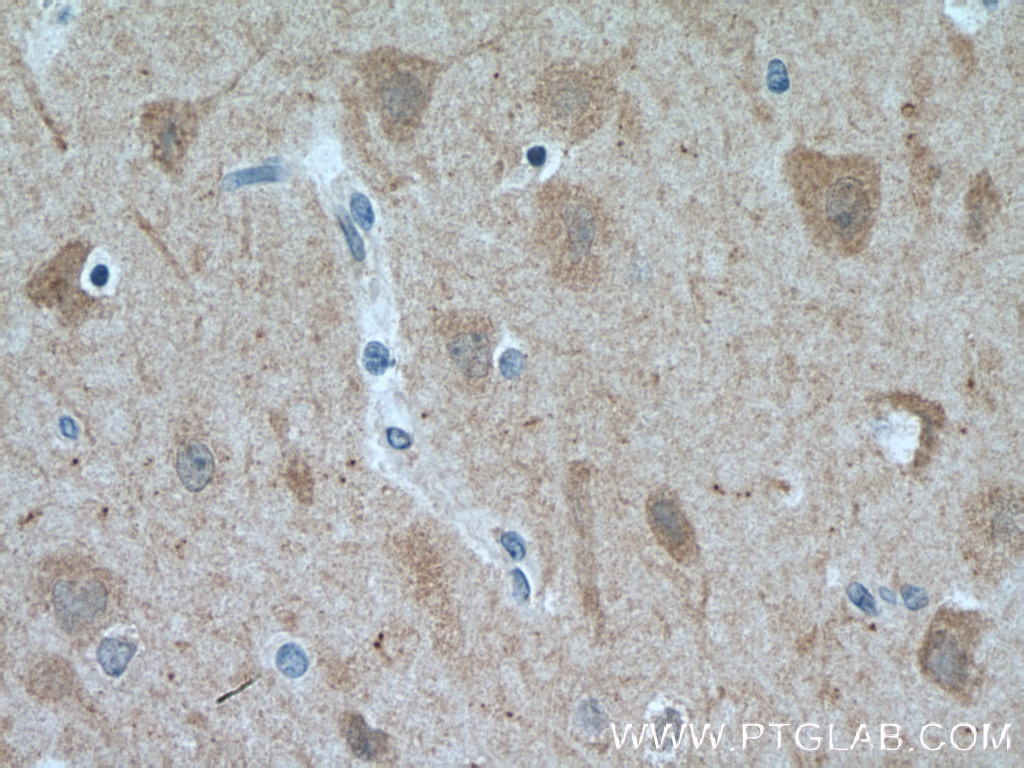 IHC staining of human brain using 25950-1-AP