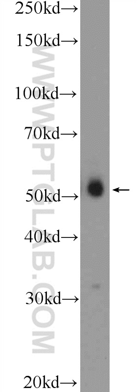 WB analysis of HeLa using 25950-1-AP