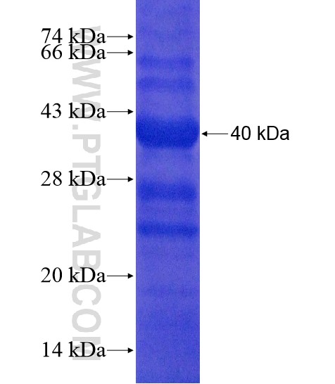 FBXL17 fusion protein Ag20436 SDS-PAGE FBXL17 fusion protein Ag20436 SDS-PAGE