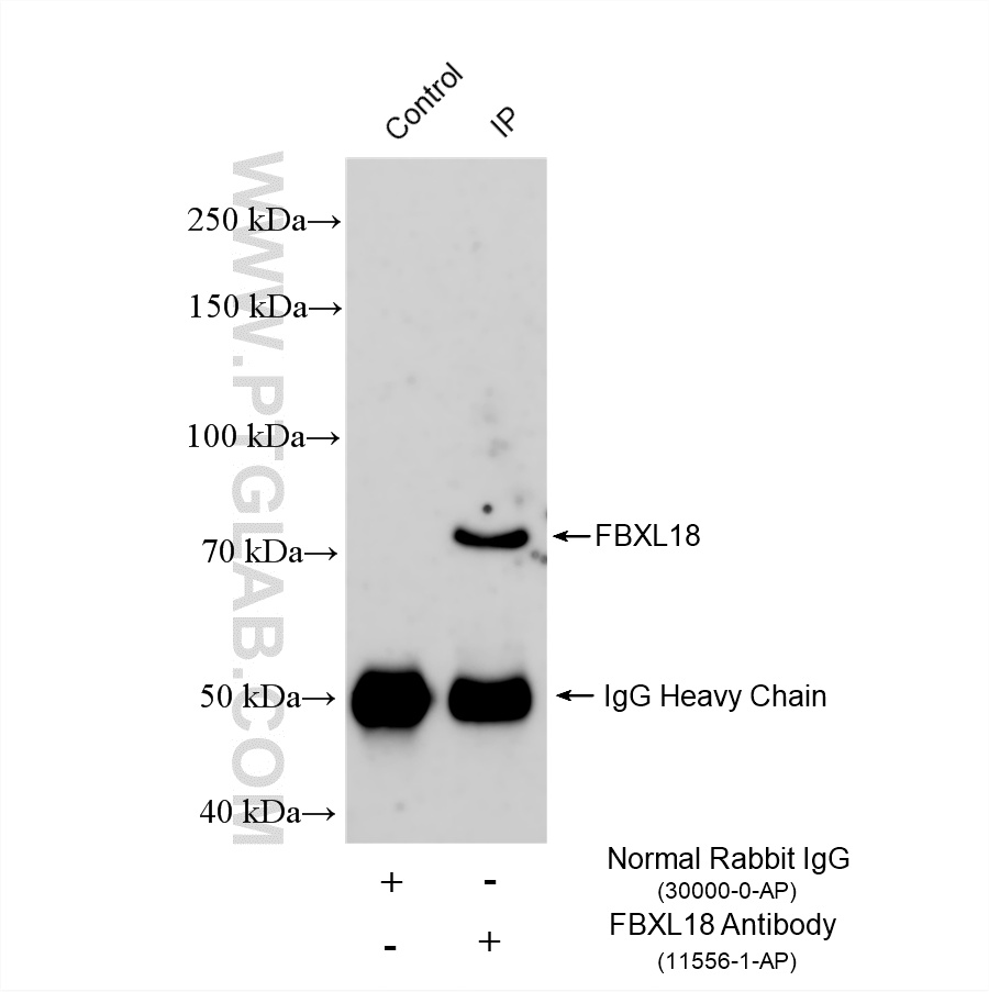 IP experiment of U-118 MG using 11556-1-AP IP experiment of U-118 MG using 11556-1-AP