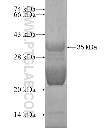 FBXL19 fusion protein Ag20152 SDS-PAGE FBXL19 fusion protein Ag20152 SDS-PAGE