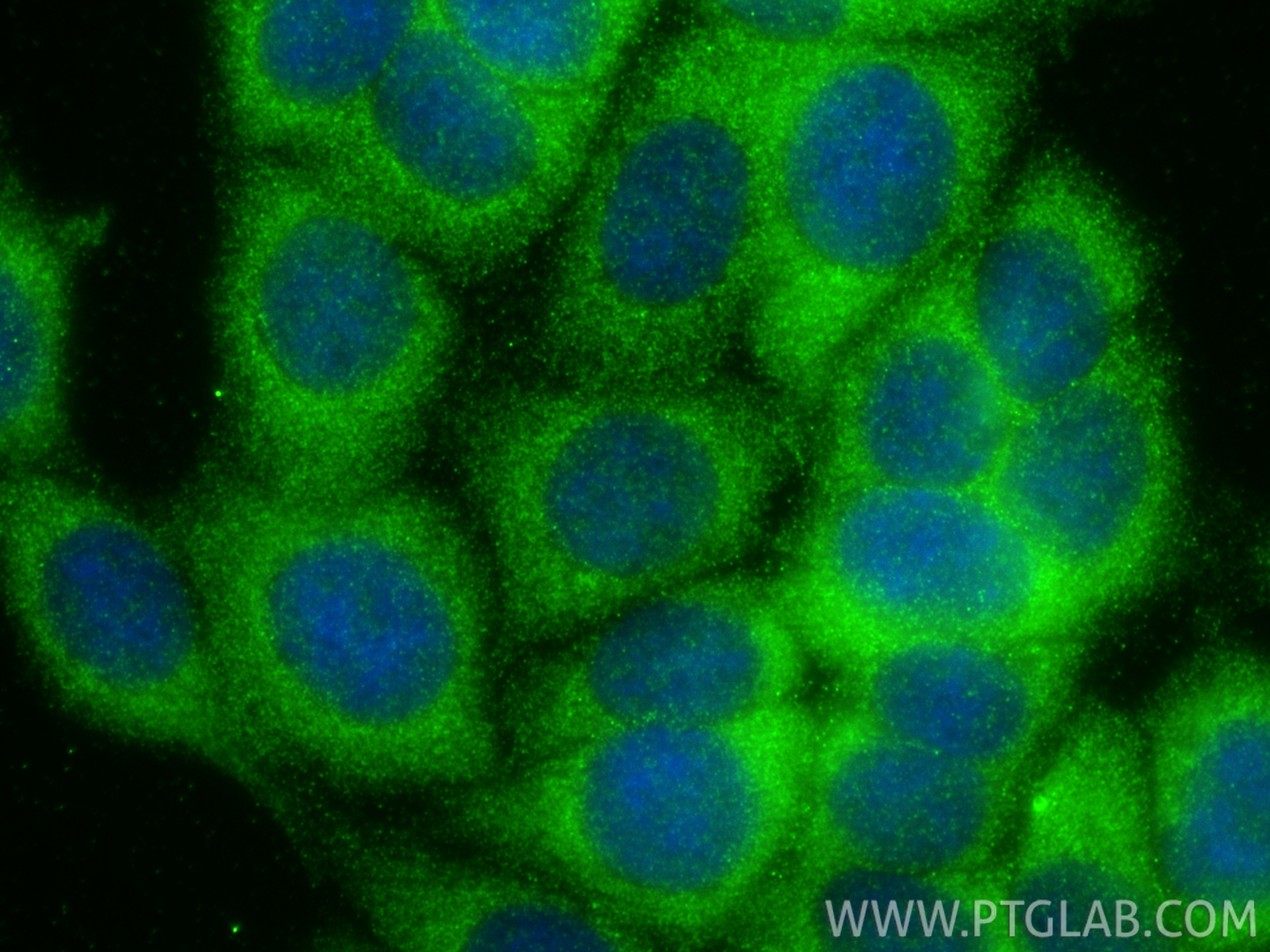 IF Staining of MCF-7 using 20949-1-AP (same clone as 20949-1-PBS) IF Staining of MCF-7 using 20949-1-AP (same clone as 20949-1-PBS)