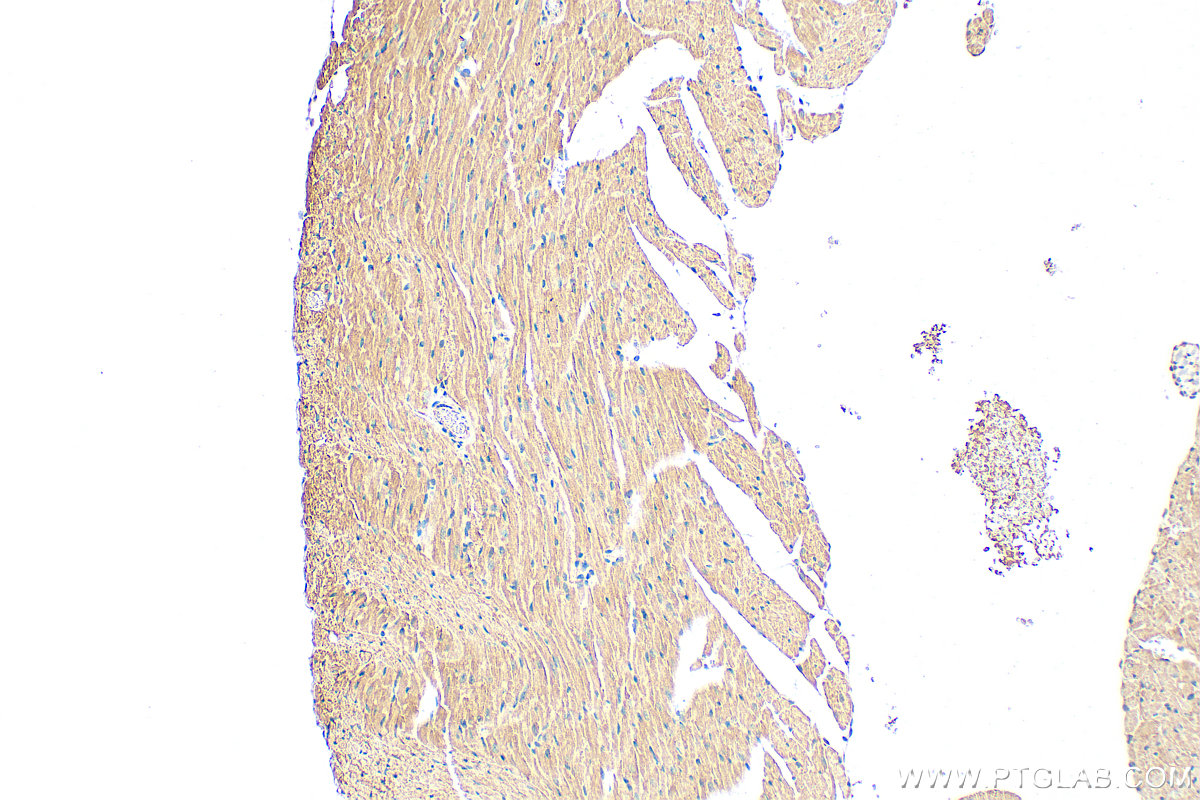 IHC staining of mouse heart using 21437-1-AP