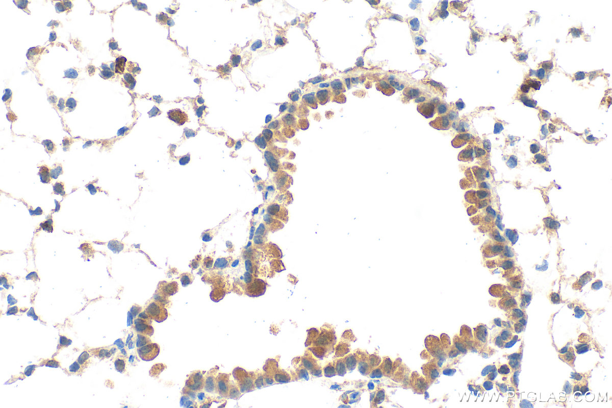 IHC staining of mouse lung using 21437-1-AP