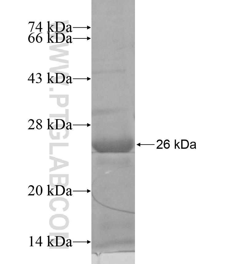 FBXL21 fusion protein Ag17343 SDS-PAGE