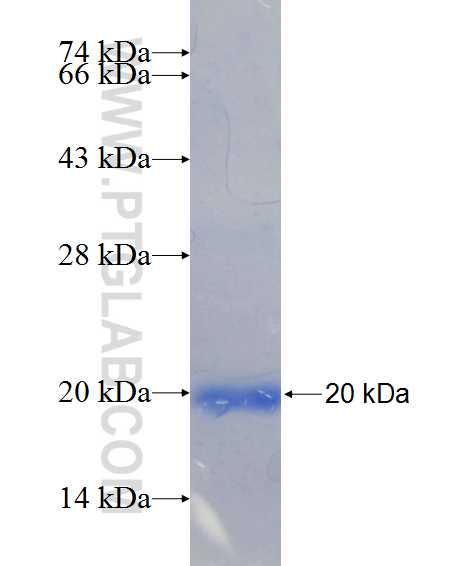 FBXO11 fusion protein Ag24401 SDS-PAGE