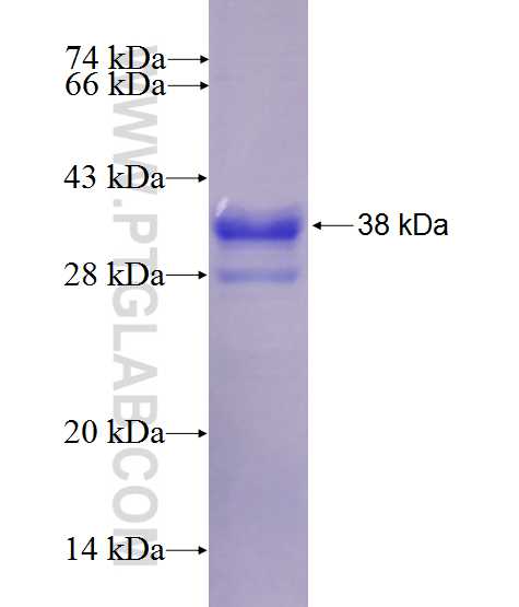 FBXO16 fusion protein Ag27580 SDS-PAGE FBXO16 fusion protein Ag27580 SDS-PAGE