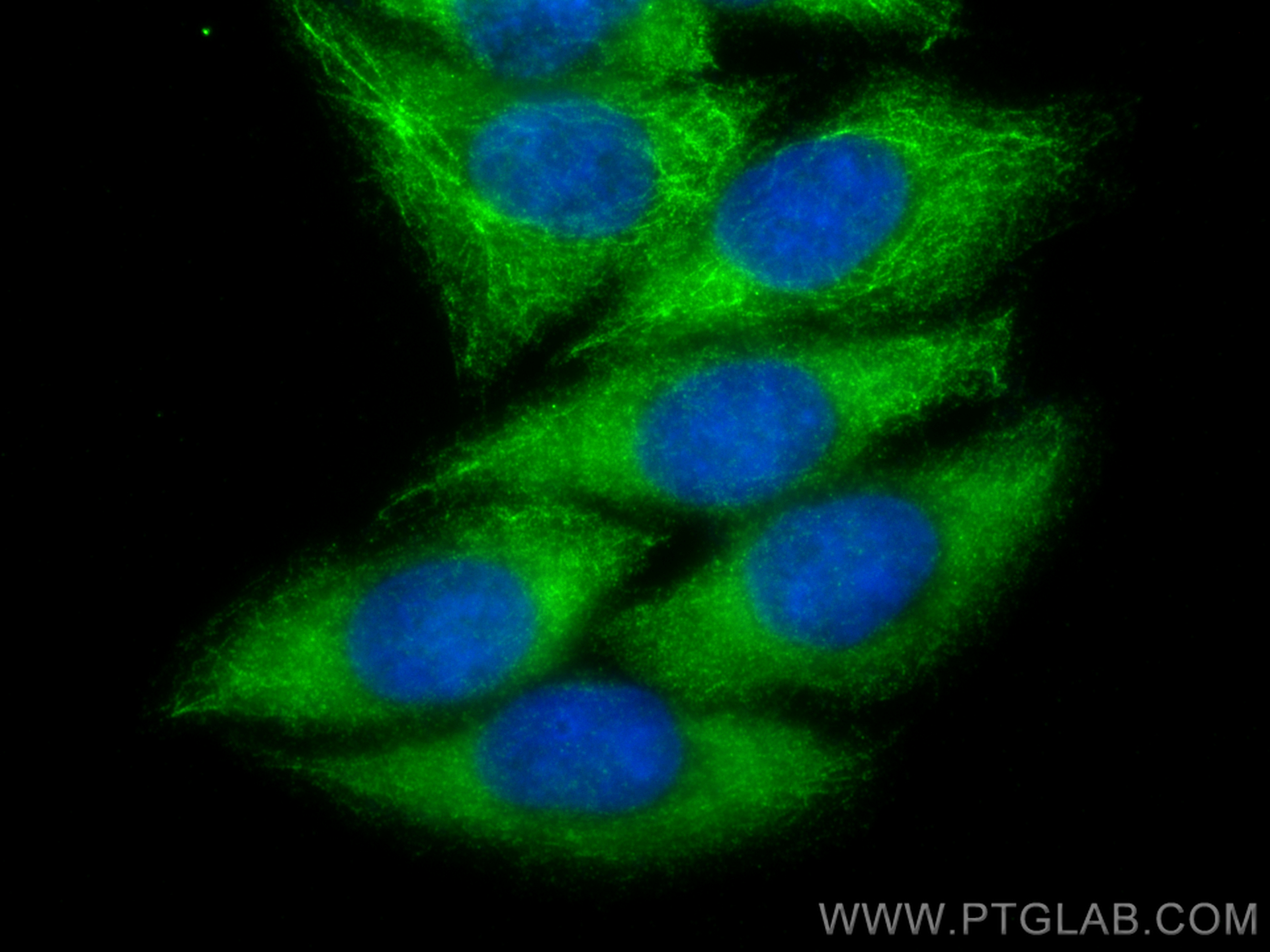 Immunofluorescent analysis of (-20°C Ethanol) fixed HepG2 cells using FBXO17 antibody (12844-1-AP) at dilution of 1:400 and CoraLite®488-Conjugated Goat Anti-Rabbit IgG(H+L) (<a class='green' href='/productredirect?CatalogNo=SA00013-2' target='_blank'>SA00013-2</a>). IF Staining of HepG2 using 12844-1-AP