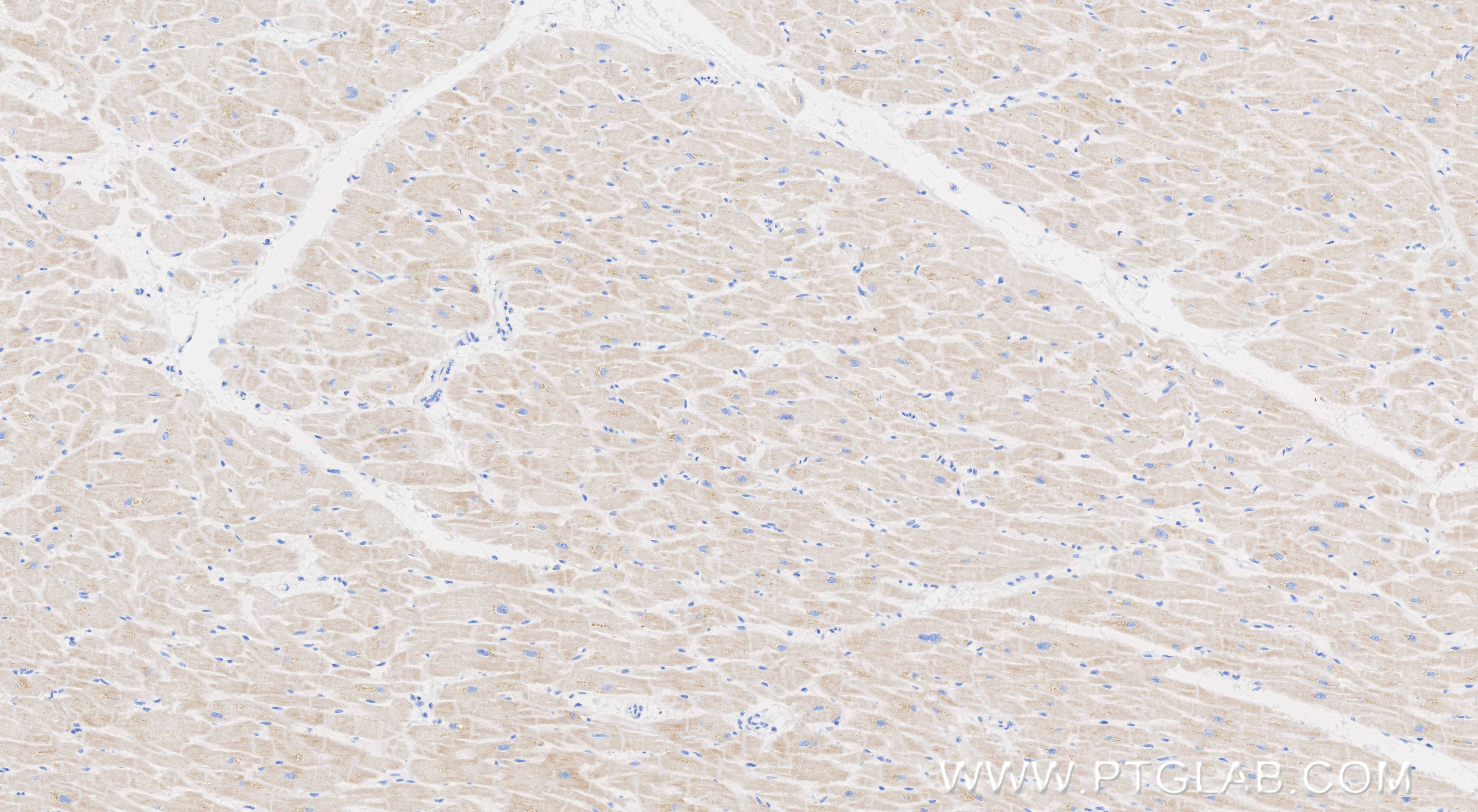 IHC staining of human heart using 85936-1-RR
