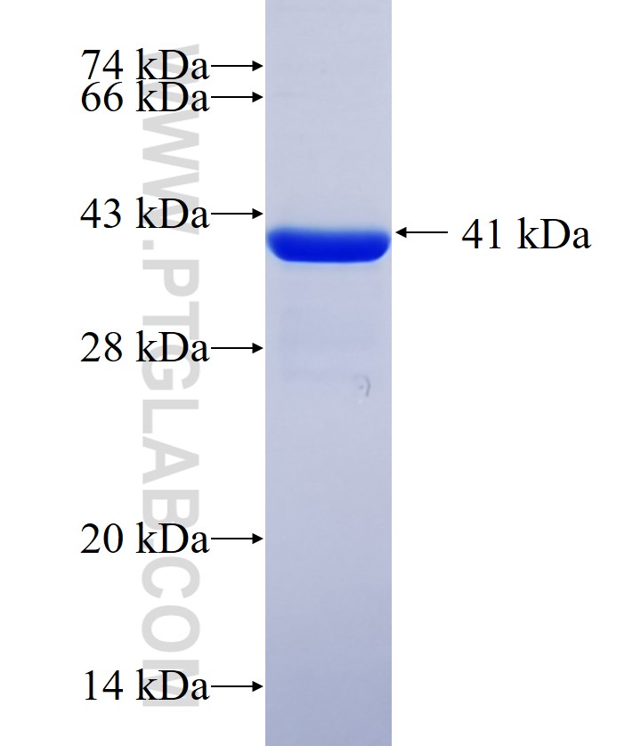 FBXO17 fusion protein Ag33125 SDS-PAGE FBXO17 fusion protein Ag33125 SDS-PAGE