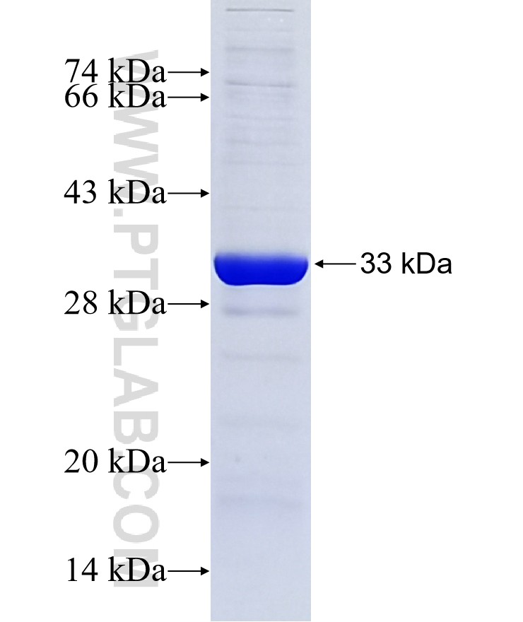 FBXO17 fusion protein Ag3867 SDS-PAGE