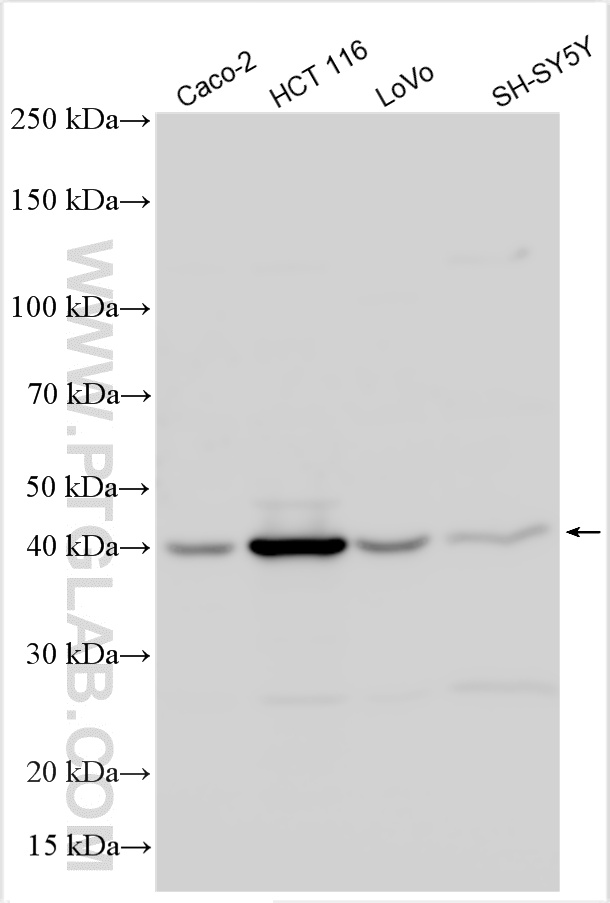 WB analysis using 14590-1-AP
