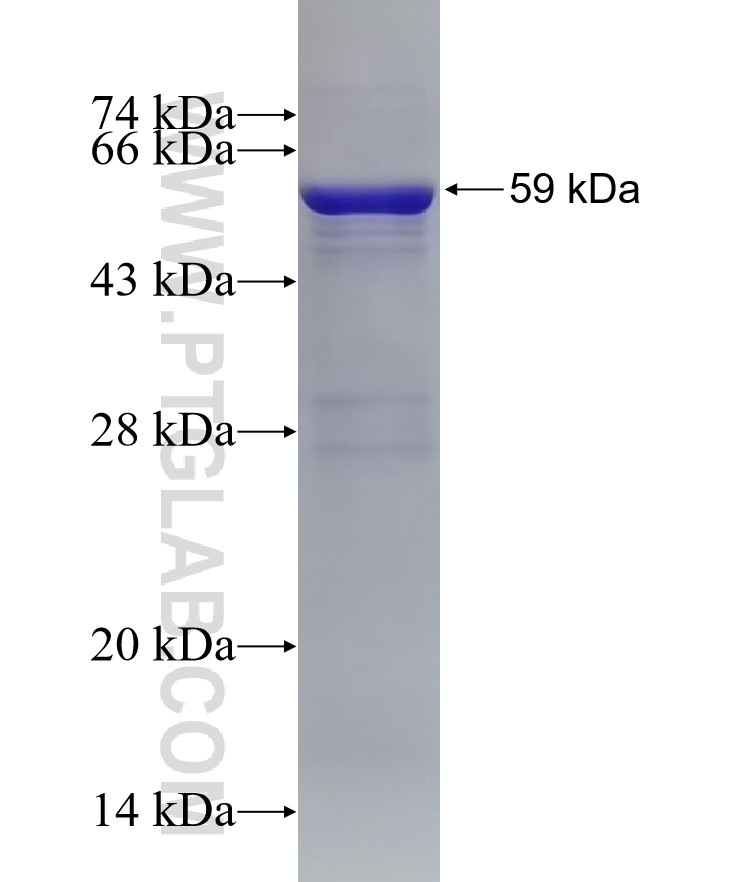 FBXO22 fusion protein Ag4485 SDS-PAGE