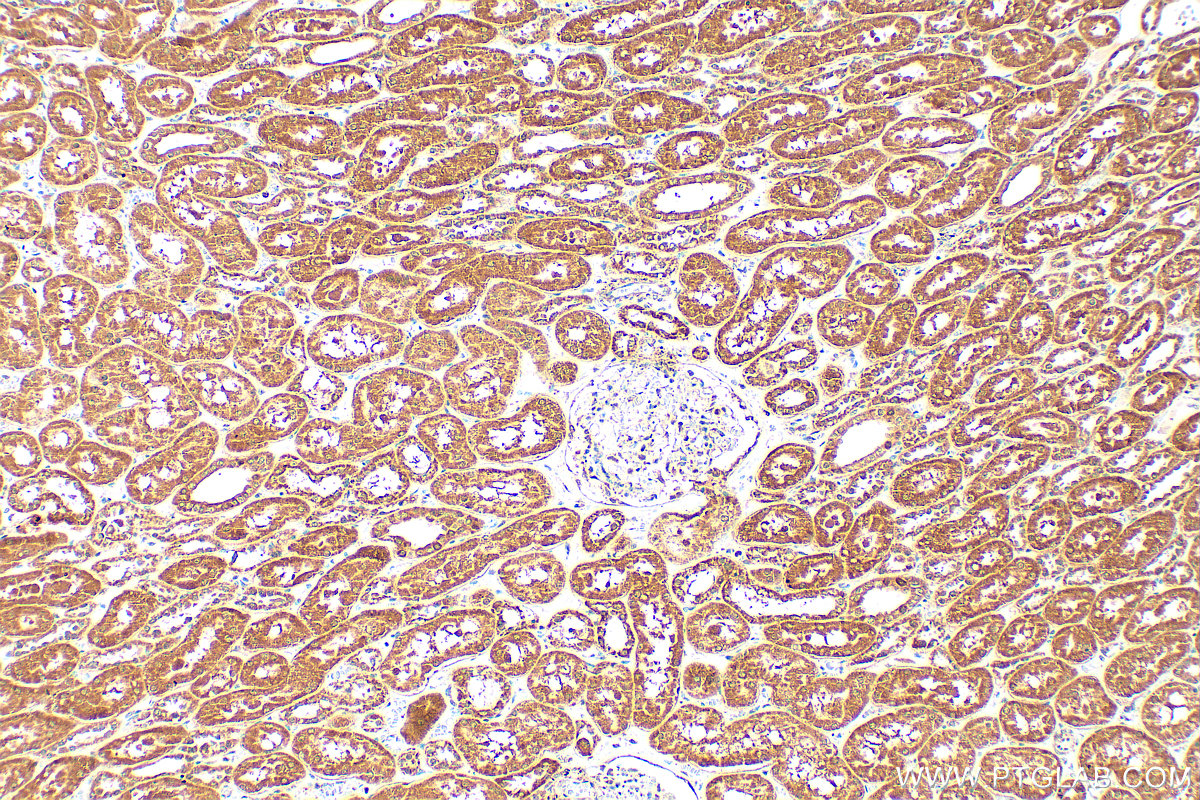 Immunohistochemical analysis of paraffin-embedded human kidney tissue slide using 14570-1-AP (FBXO27 antibody) at dilution of 1:200 (under 10x lens). Heat mediated antigen retrieval with Tris-EDTA buffer (pH 9.0). IHC staining of human kidney using 14570-1-AP