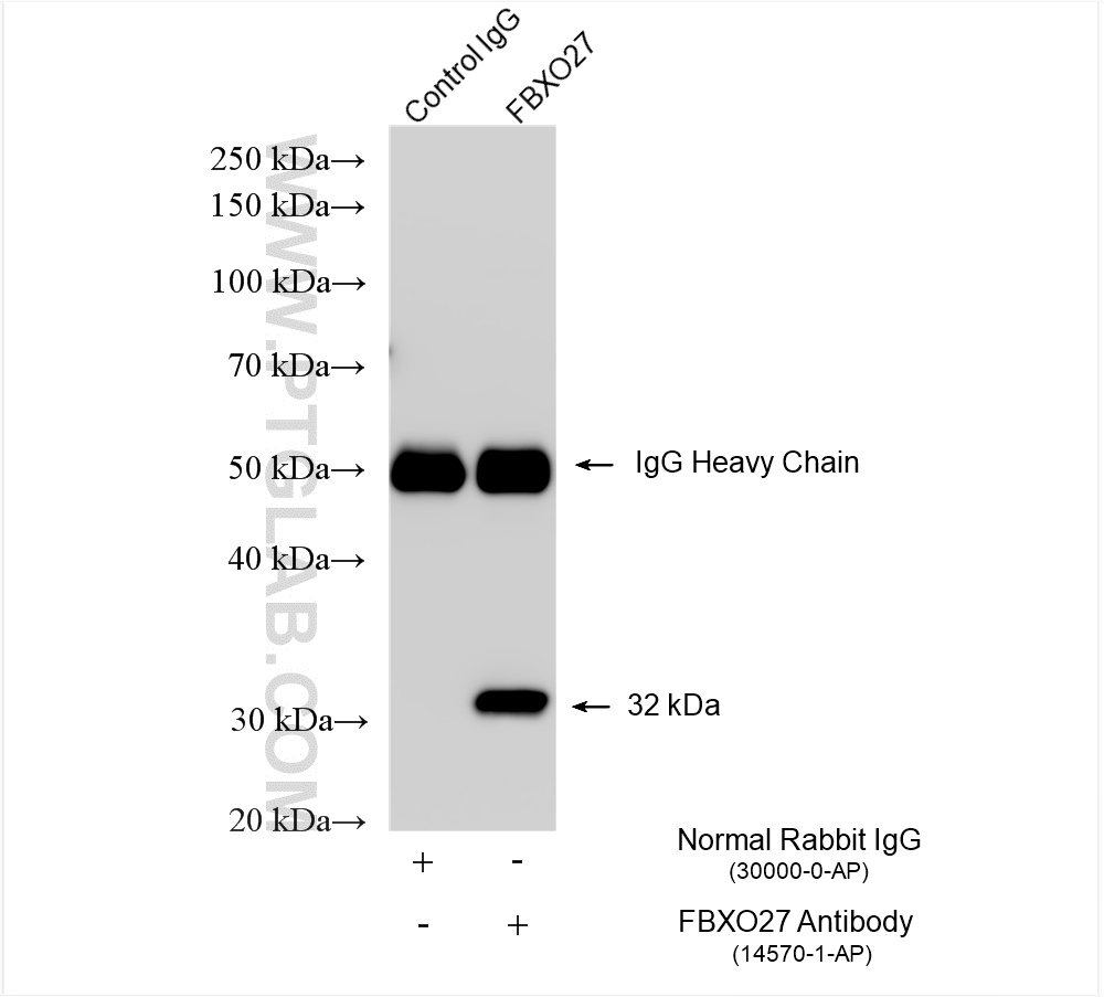 IP experiment of PANC-1 using 14570-1-AP