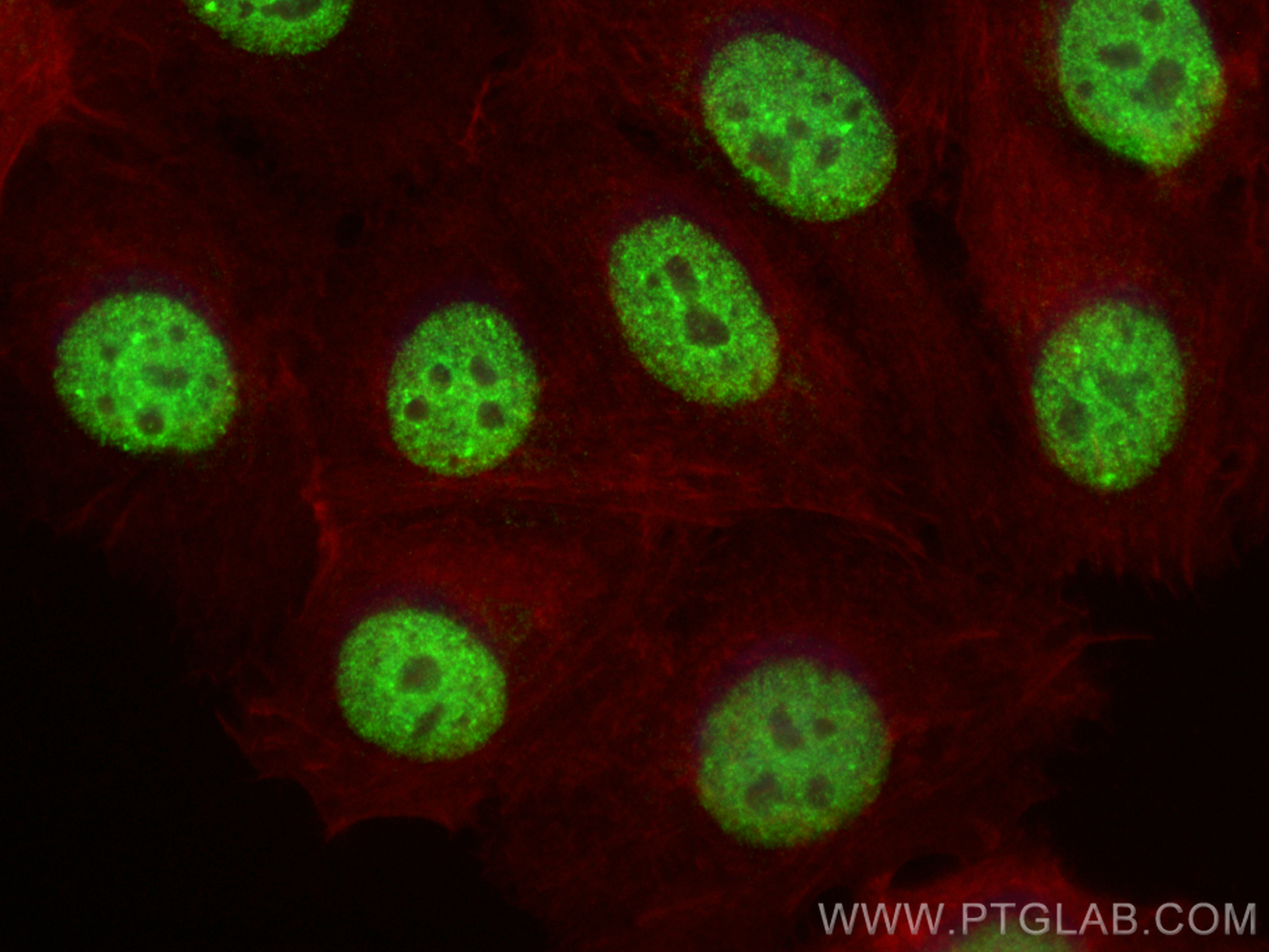 IF Staining of MCF-7 using 23381-1-AP