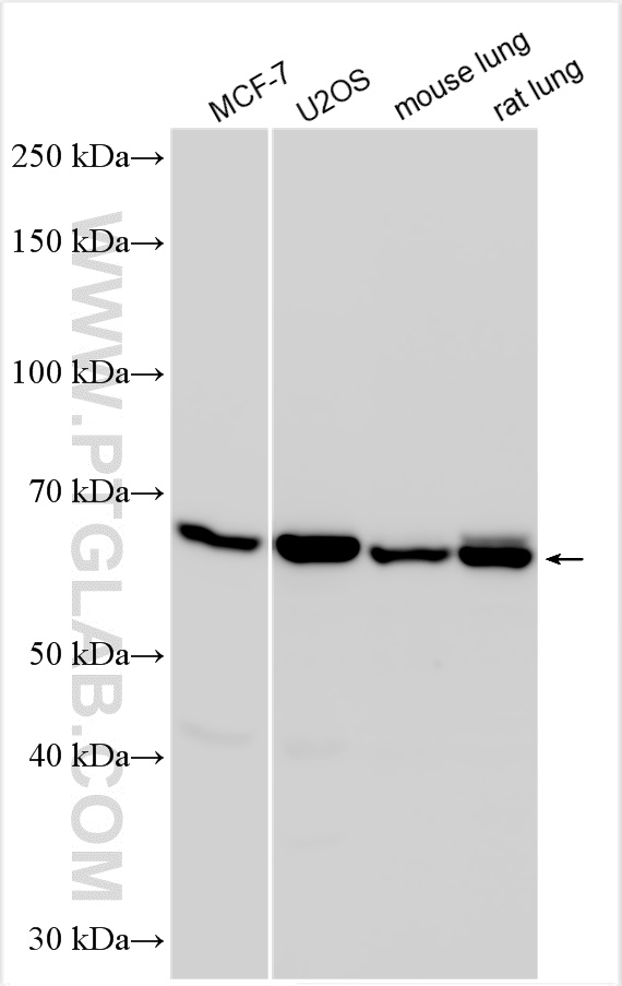 WB analysis using 23381-1-AP