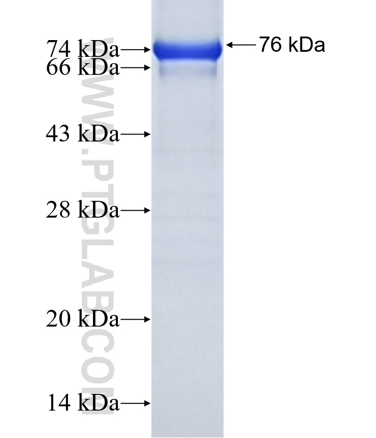 FBXO34 fusion protein Ag15372 SDS-PAGE FBXO34 fusion protein Ag15372 SDS-PAGE