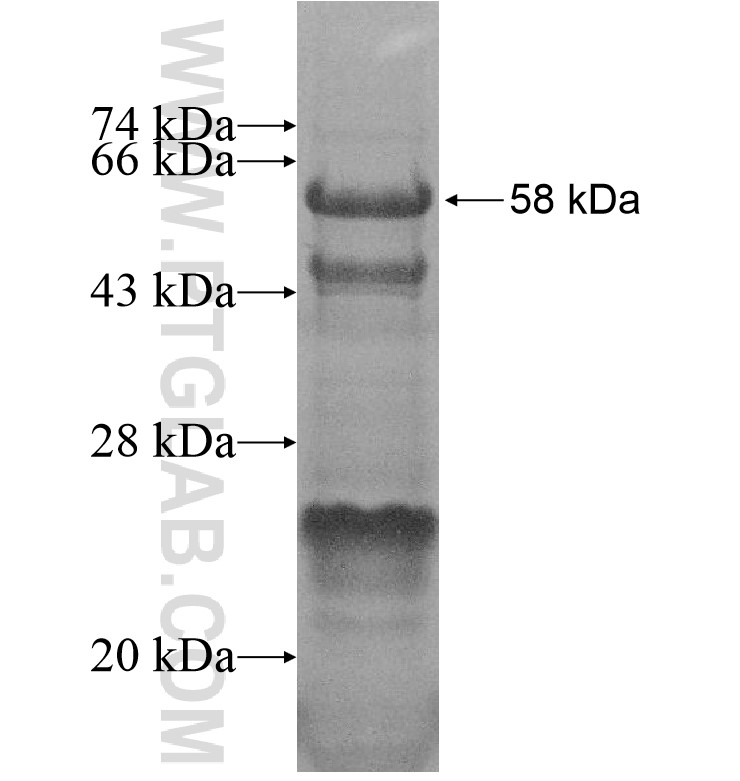 FBXO34 fusion protein Ag16919 SDS-PAGE FBXO34 fusion protein Ag16919 SDS-PAGE