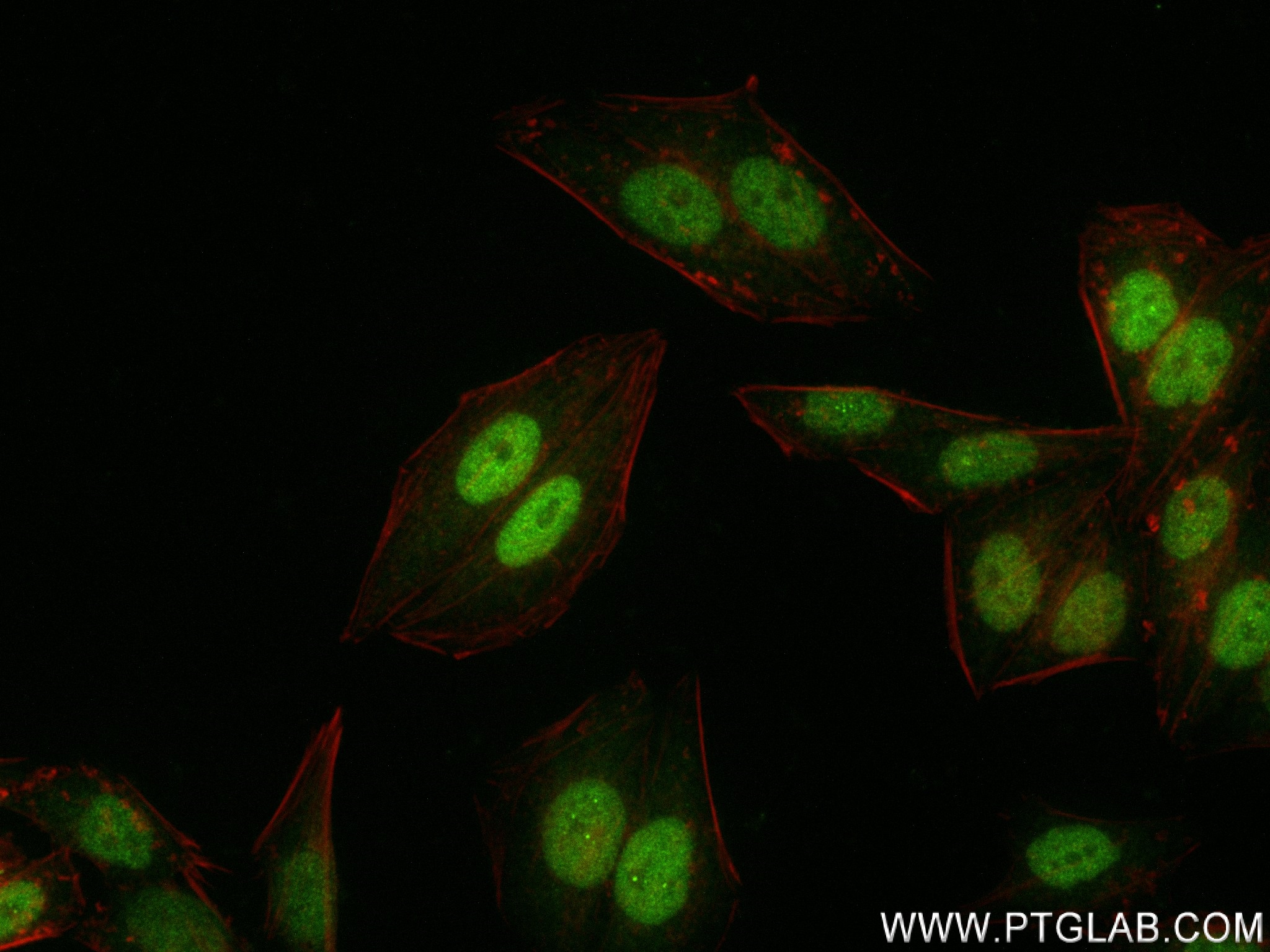 IF Staining of HepG2 using 83509-5-RR