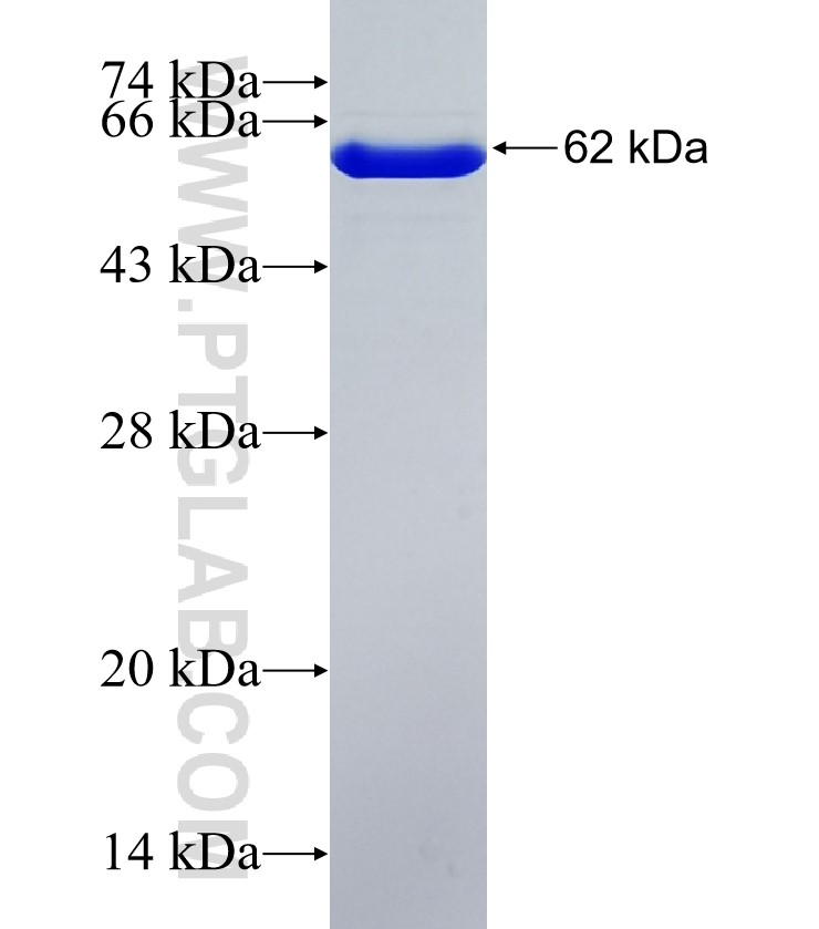 FBXO38 fusion protein Ag35444 SDS-PAGE
