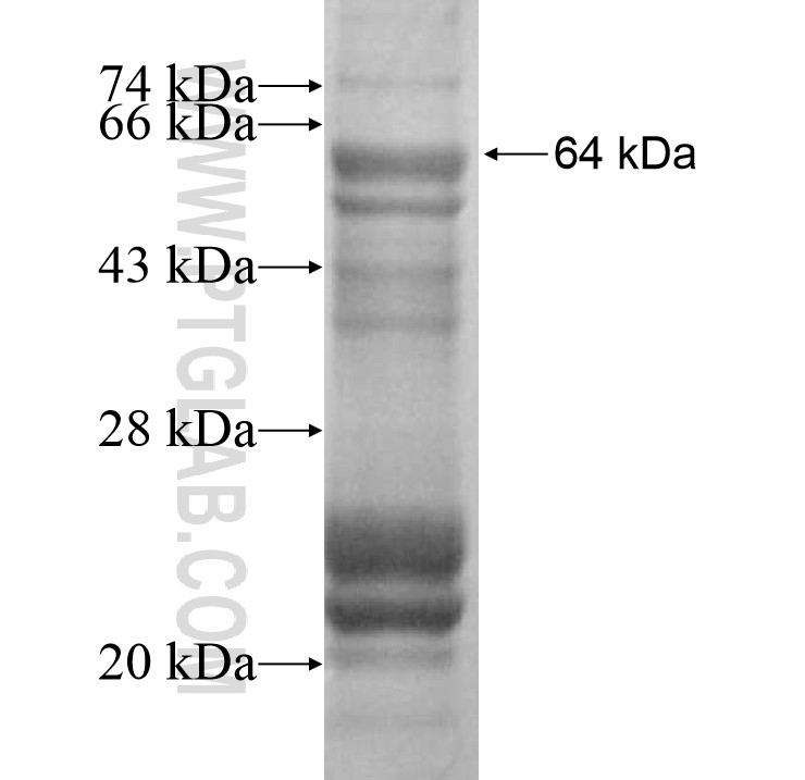 FBXO40 fusion protein Ag16272 SDS-PAGE FBXO40 fusion protein Ag16272 SDS-PAGE