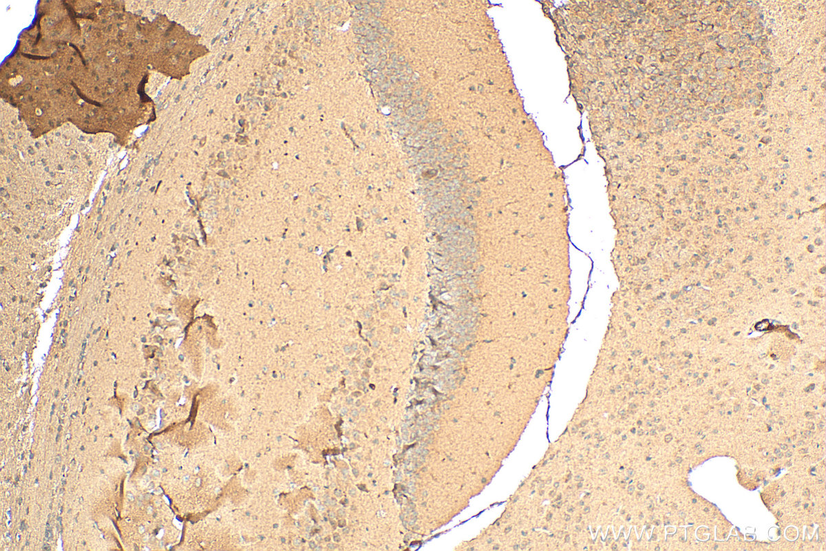 IHC staining of mouse brain using 24519-1-AP
