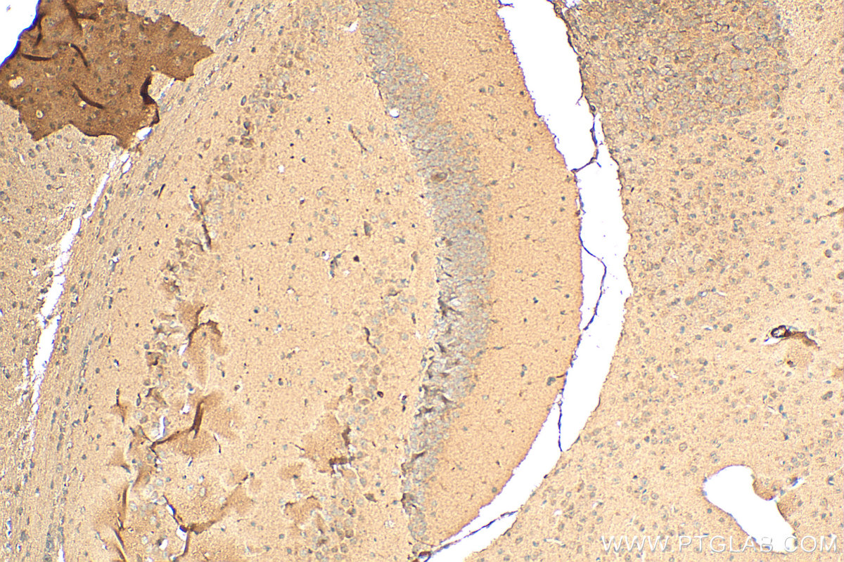 IHC staining of mouse brain using 24519-1-AP (same clone as 24519-1-PBS)