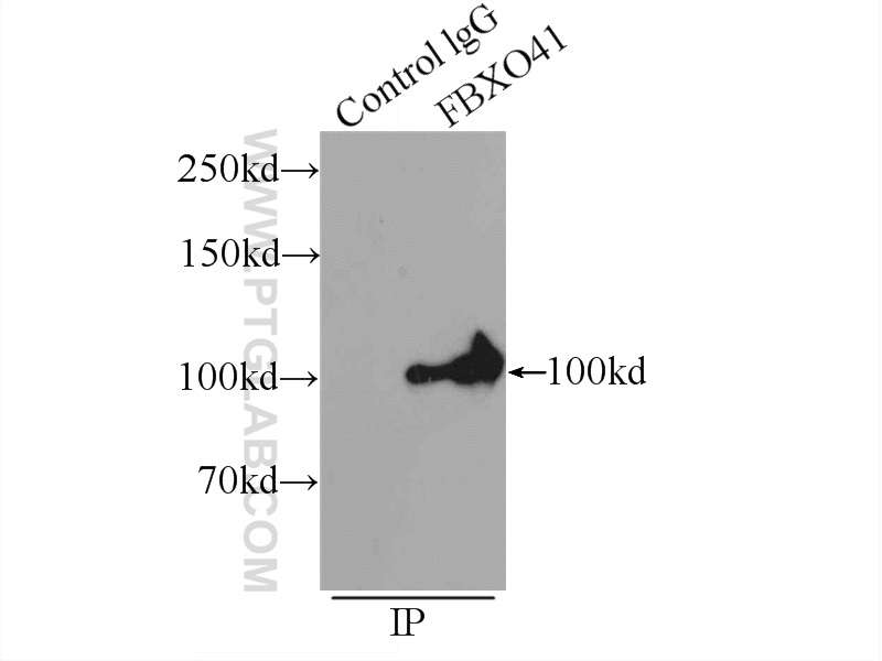 IP experiment of mouse brain using 24519-1-AP