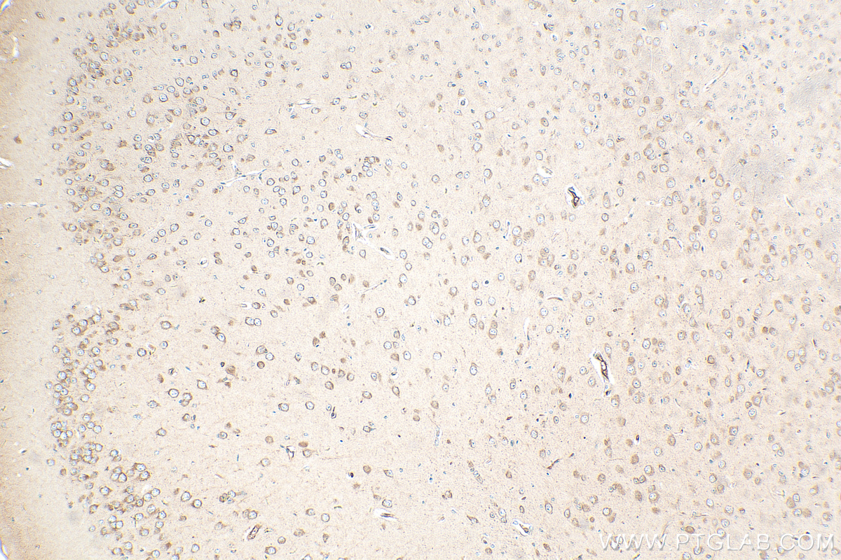 IHC staining of mouse brain using 30162-1-AP