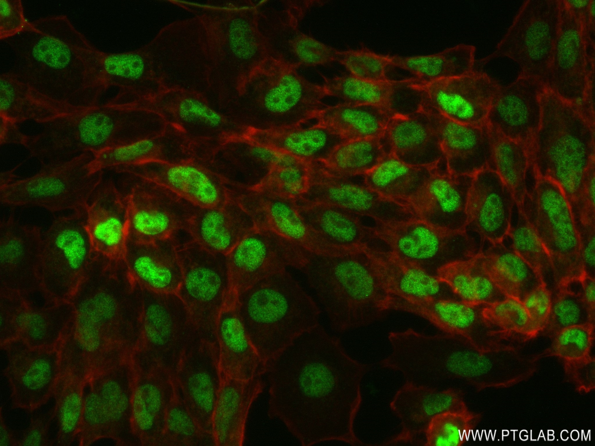 IF Staining of A431 using 82857-2-RR