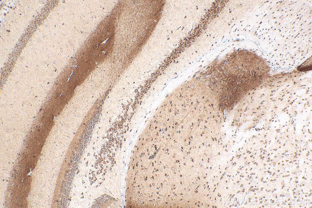 IHC staining of mouse brain using 82857-2-RR