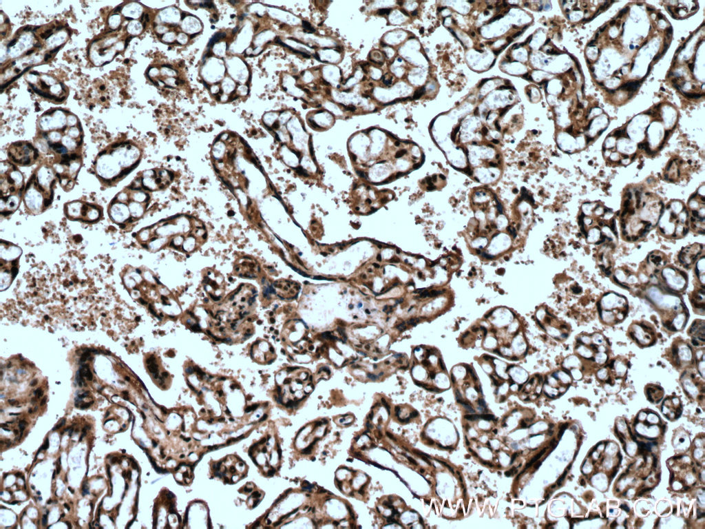 IHC staining of human placenta using 10872-1-AP